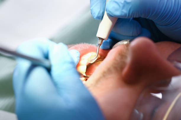 Best Emergency Dental Care for Sports Injuries in Flippin, AR